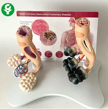 Альвеолярная модель, сравнительная модель для изучения анатомии курящих и здоровых альвеол, анатомическая модель человеческого органа для школы 1