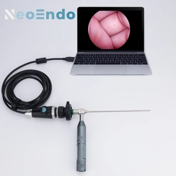 Медицинская USB-Эндоскопическая Камера Full HD 1080P Для ЛОР-/Орального/Пэт-осмотра Или Хирургической операции 1